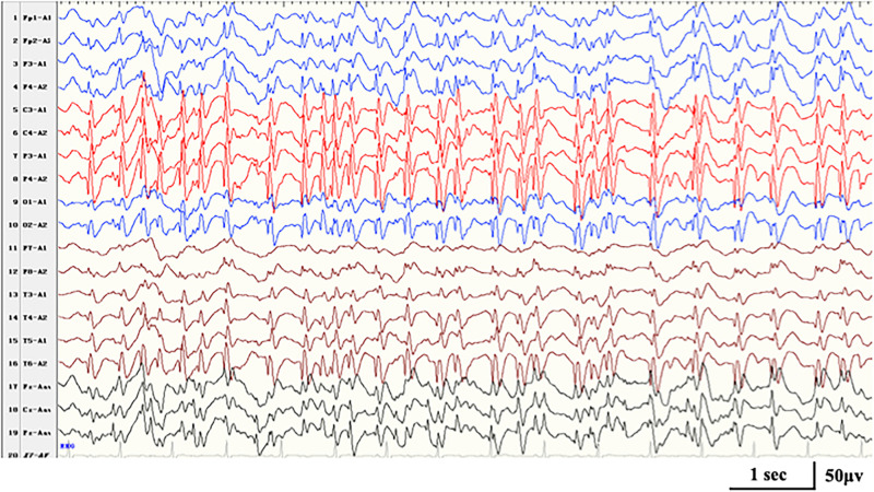 FIGURE 3