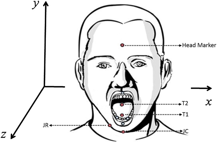 Fig. 1