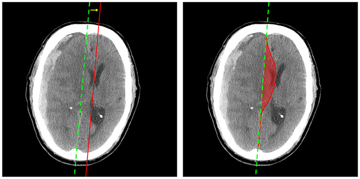 Fig. 1: