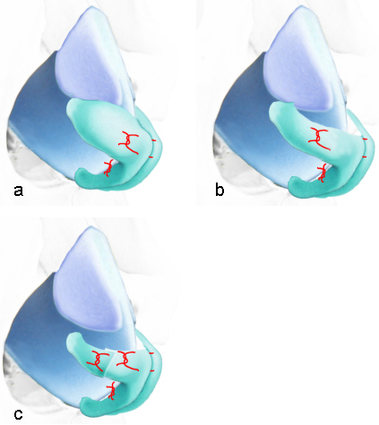 Figure 12