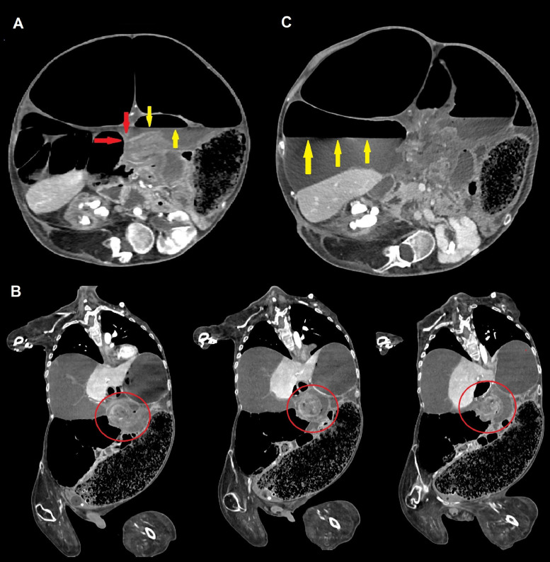 Fig 2