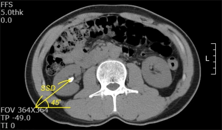 FIG. 1