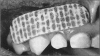84