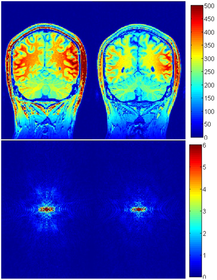 Figure 11