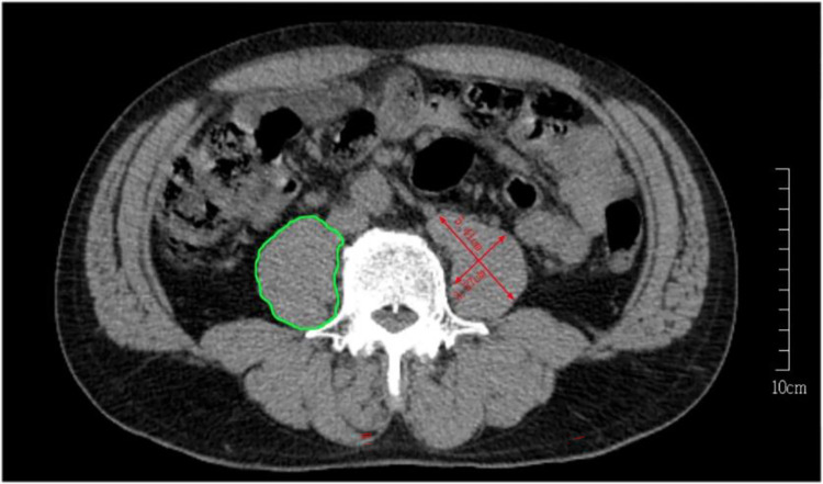 Fig 2