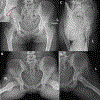 Figure 1A-D.