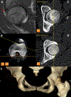 Figure 2A-E.