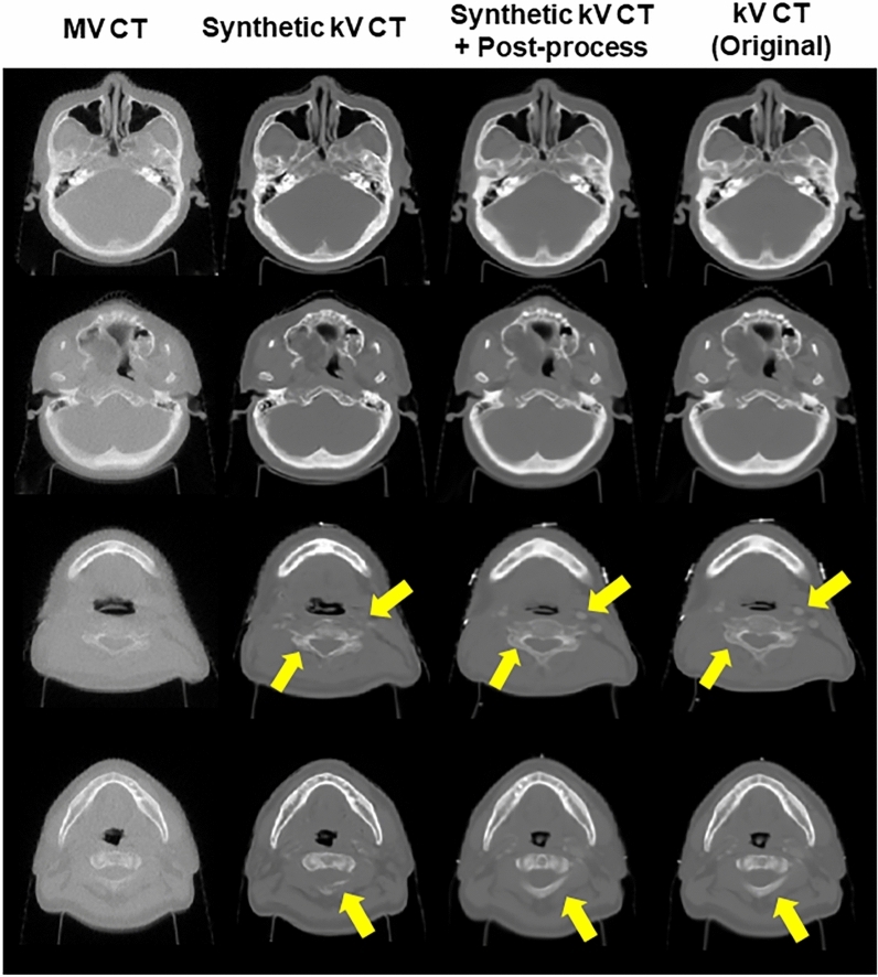 Figure 4