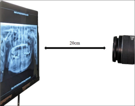 Figure 17