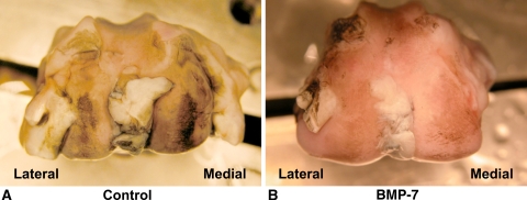 Fig. 2A–B