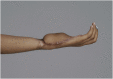 Fig. 5
