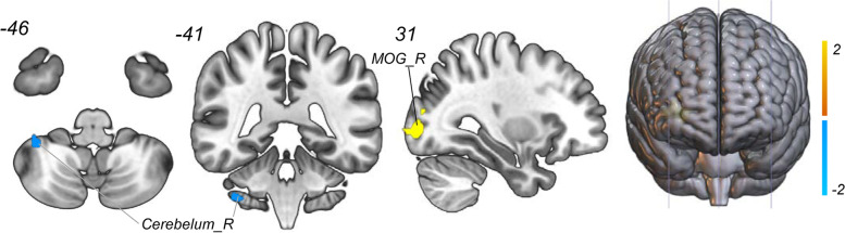 Fig. 4