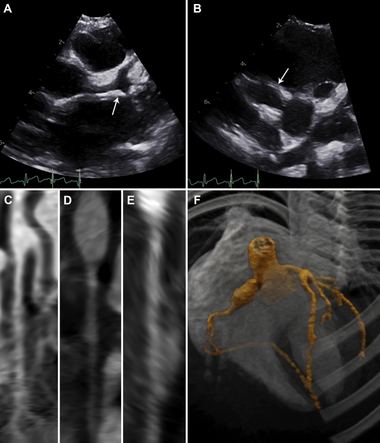 Figure 4