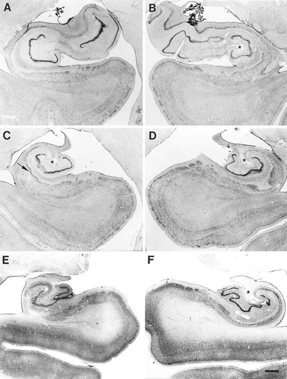 Fig. 11.