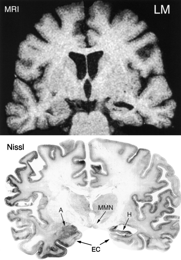 Fig. 9.