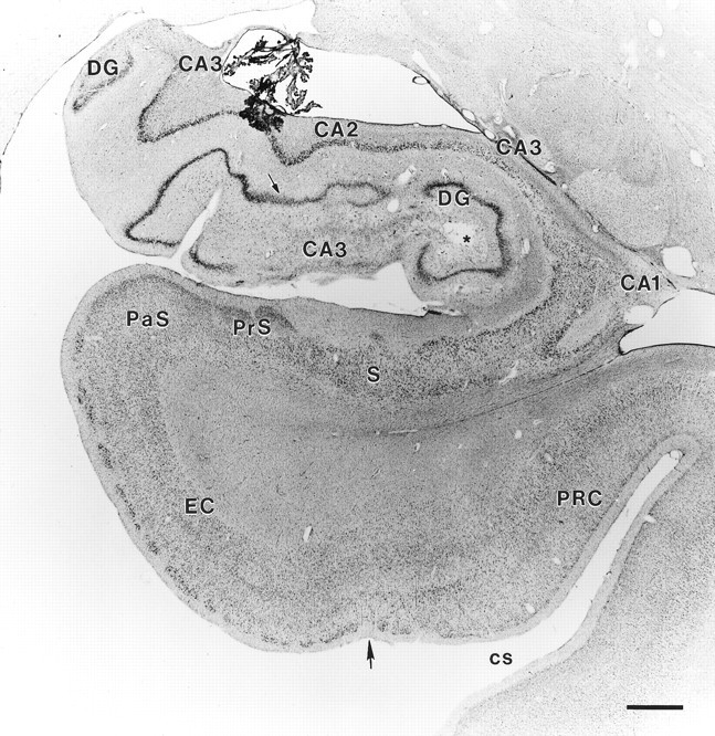 Fig. 10.