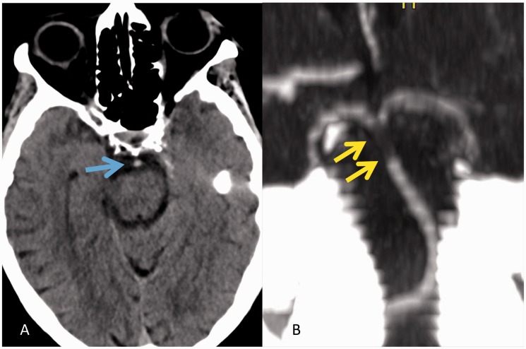 Figure 3.