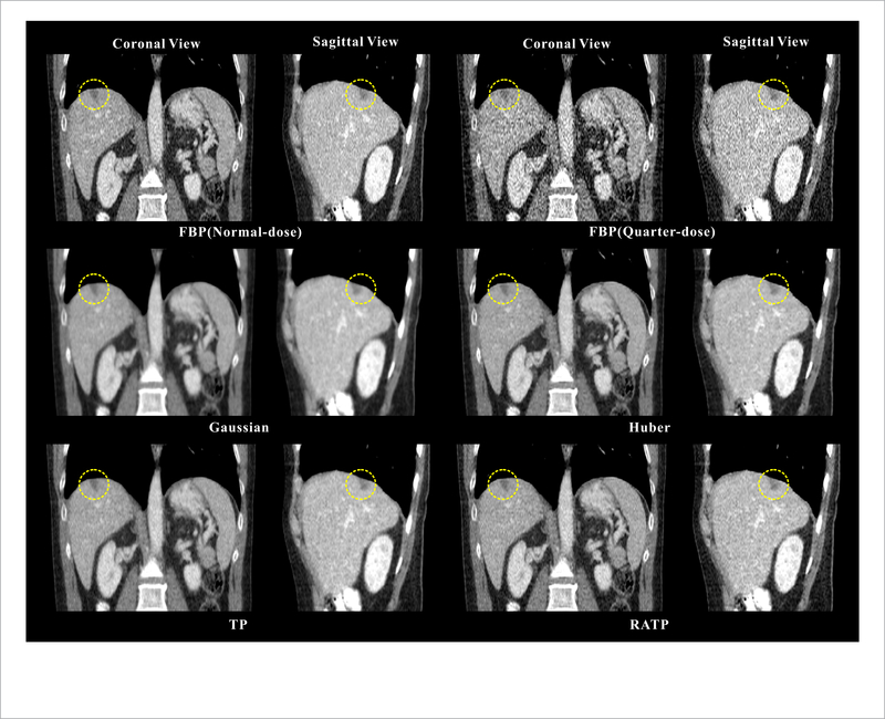 Figure 11.