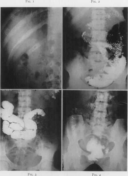 Fig. 1., Fig. 2., Fig. 3., Fig. 4.