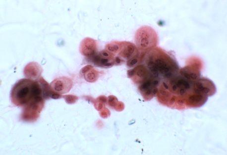 Figure 11
