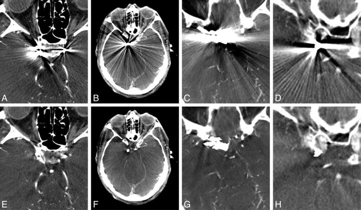 Fig 3.