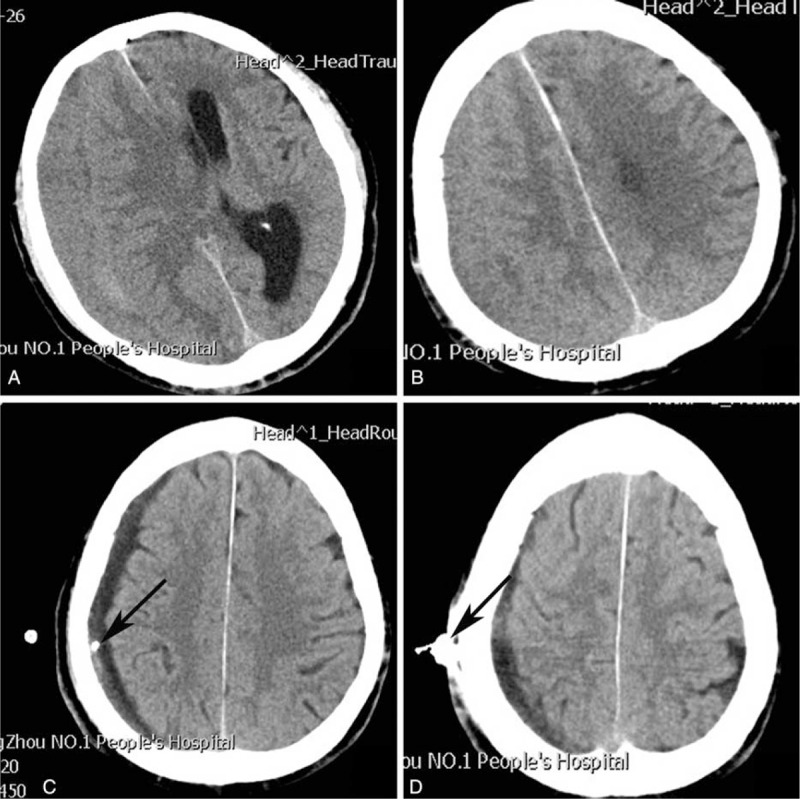 FIGURE 3