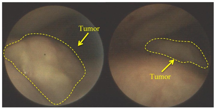 Figure 20