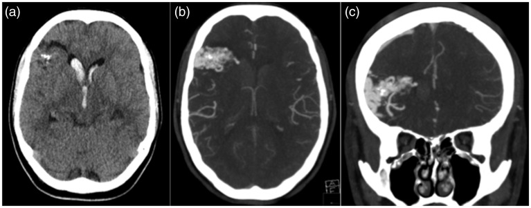 Figure 1.