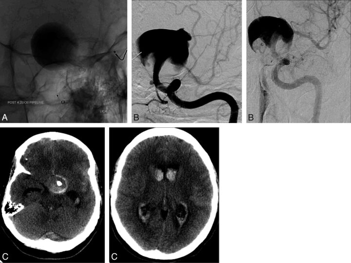 Fig 2.