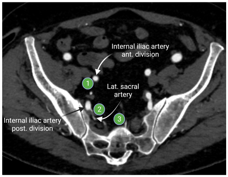 Figure 4