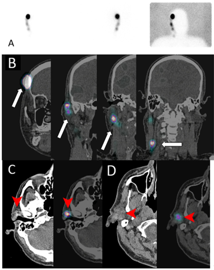 Figure 17