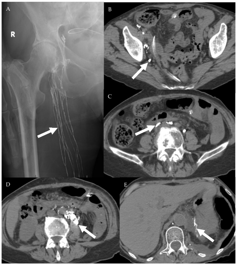 Figure 15