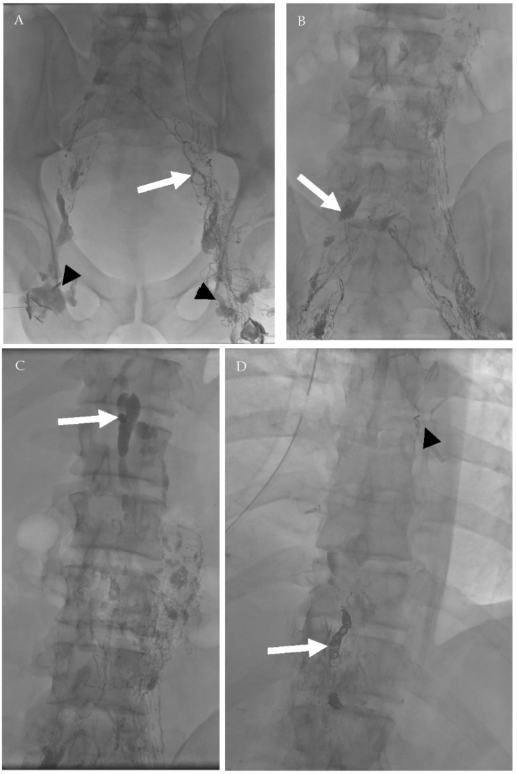 Figure 16