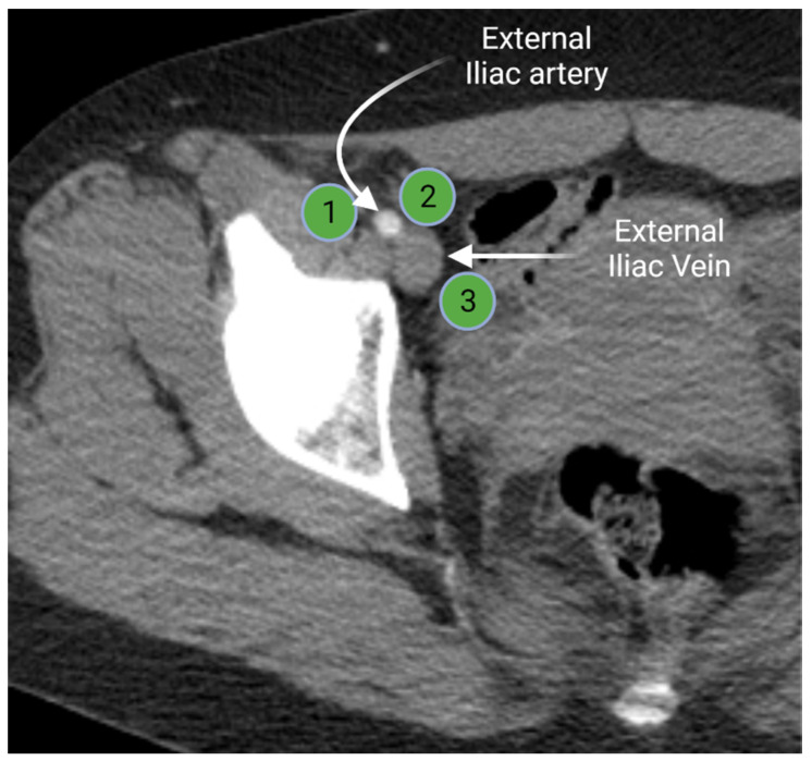 Figure 3