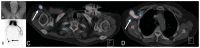 Figure 18