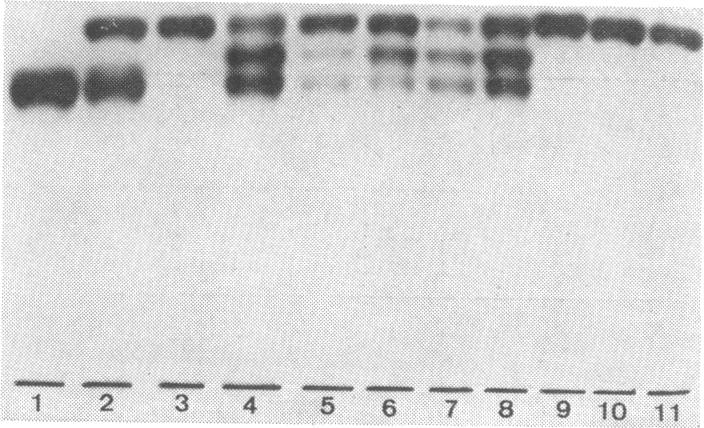 graphic file with name pnas00076-0125-a.jpg