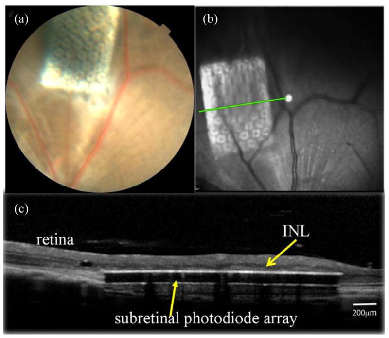 Figure 11