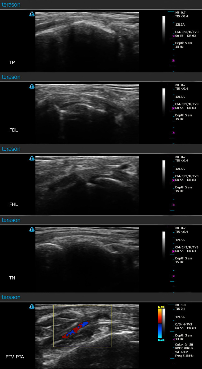 Figure 6