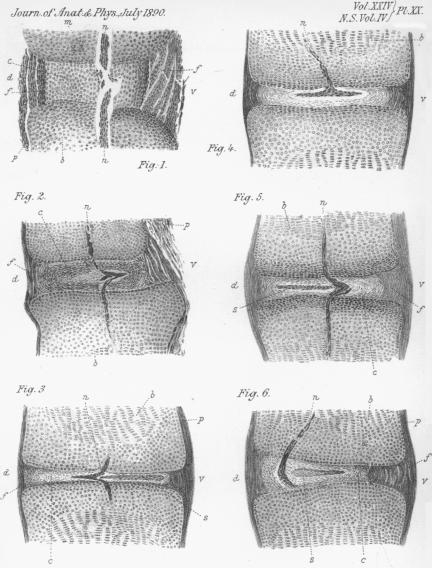 Figs. 1-6