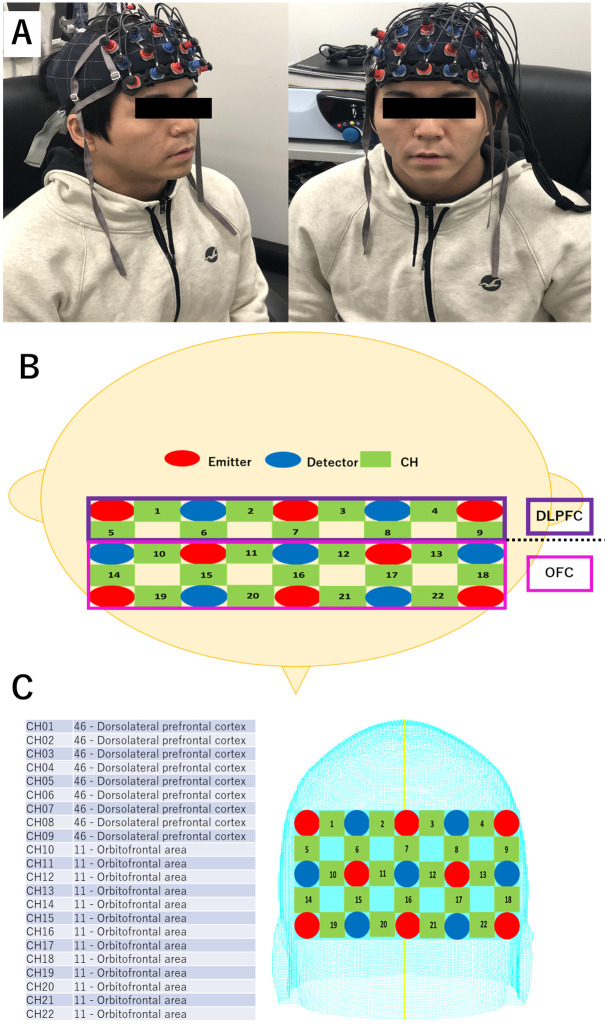 Fig 2