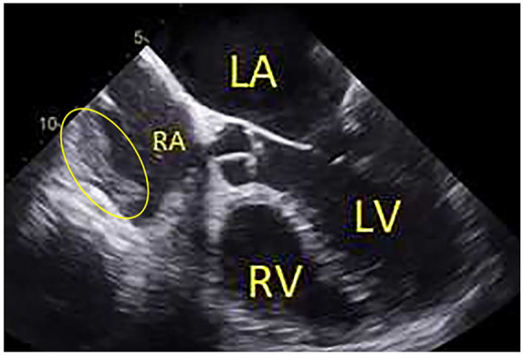 Figure 2.