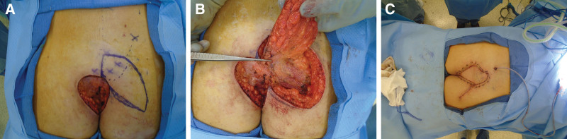 Fig. 6.