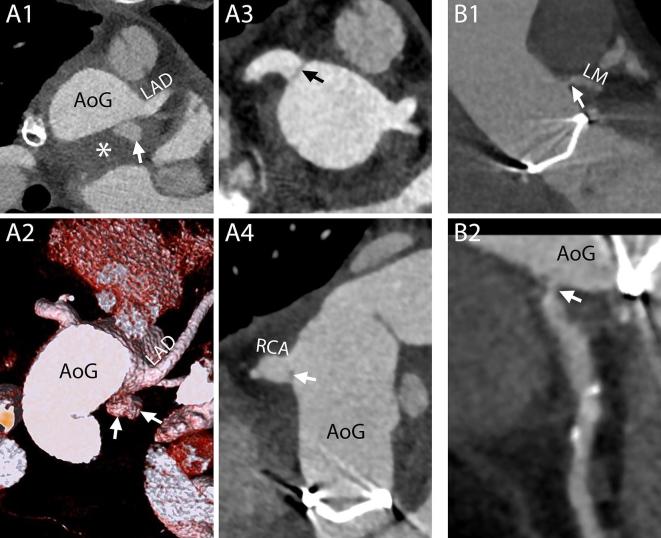 Figure 14. 