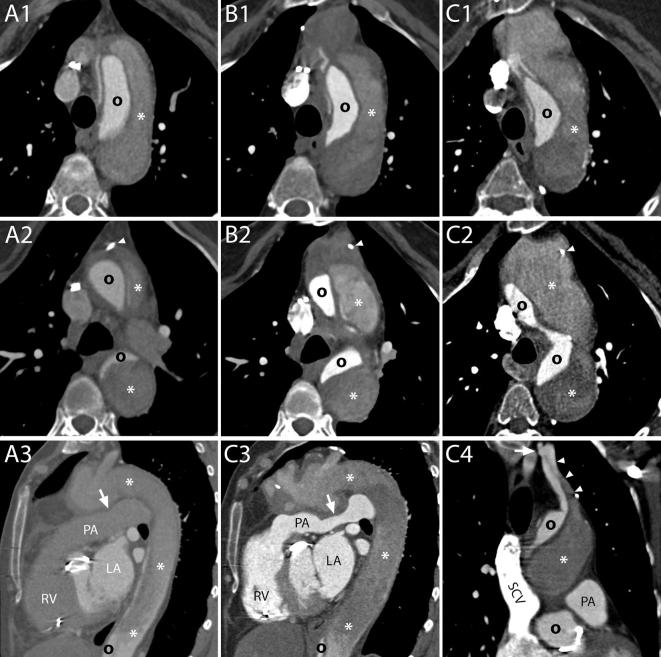 Figure 16. 