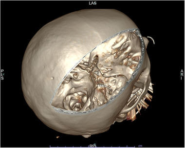 FIGURE 3