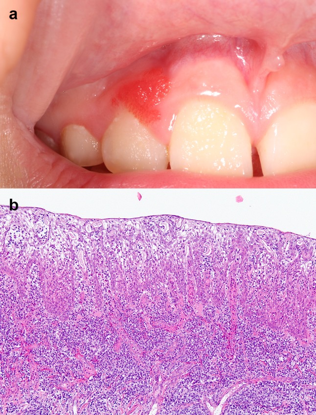 Fig. 6