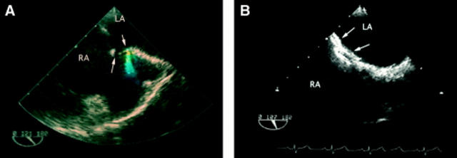 Figure 2  