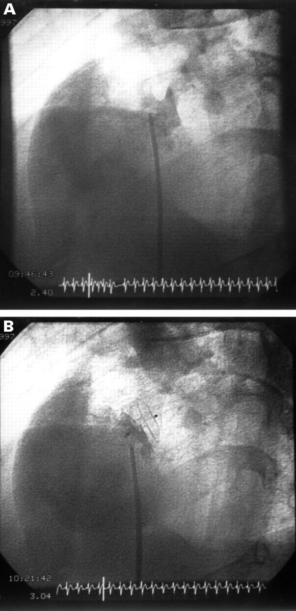 Figure 1  