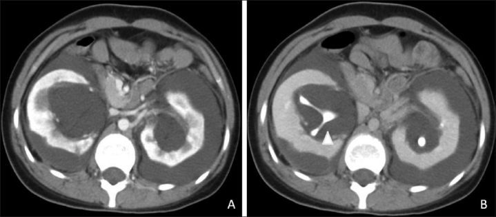 Figure 3 (A,B)