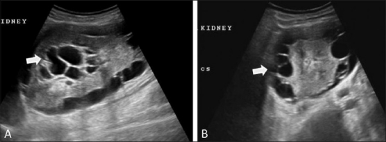 Figure 1 (A,B)